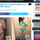 Image for article titled Site Uses Pic of Woman with Anorexia in 'Amazing' Weight Loss Post